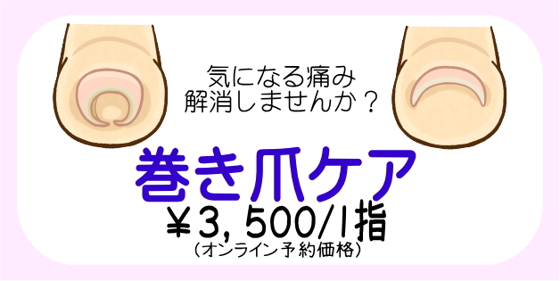 巻き爪ケア